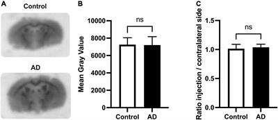 Impact of Donepezil on Brain Glucose Metabolism Assessed Using [18F]2-Fluoro-2-deoxy-D-Glucose Positron Emission Tomography Imaging in a Mouse Model of Alzheimer’s Disease Induced by Intracerebroventricular Injection of Amyloid-Beta Peptide